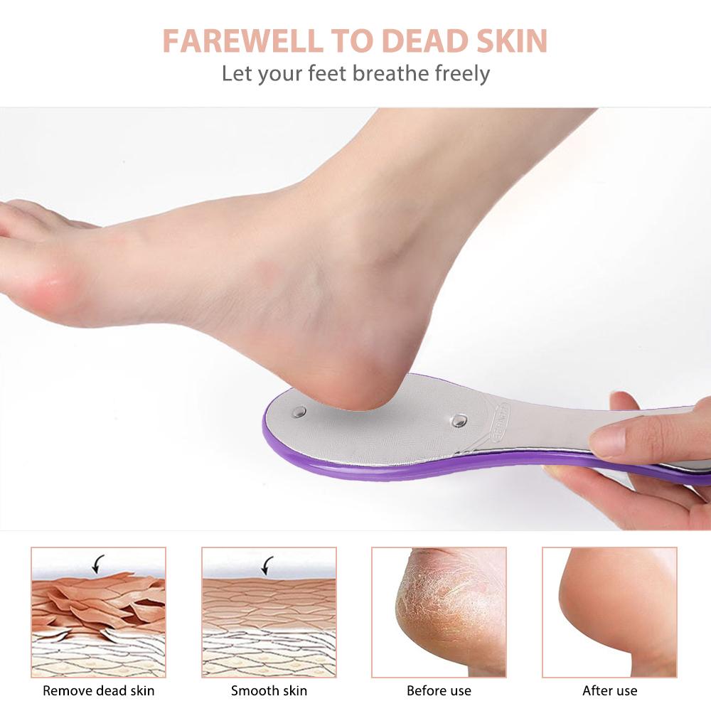 Foot File Callus Remover